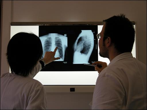 שני רופאים מביטים בצילומי רנטגן של בית חזה